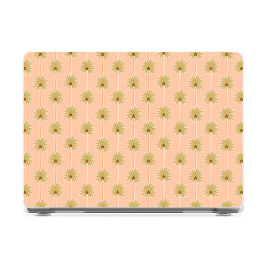 Las Palmeras | Palm Tree Print Laptop Shell - 16" MacBook Pro