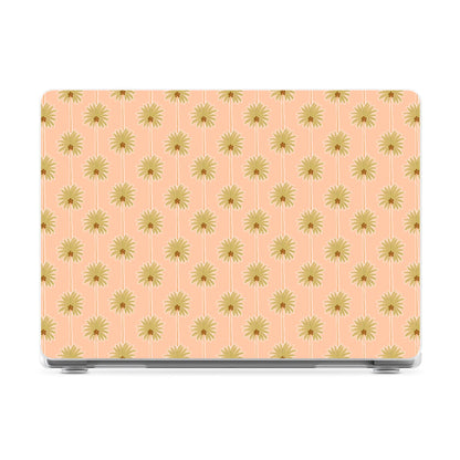 Las Palmeras | Palm Tree Print Laptop Shell - 14" MacBook Pro