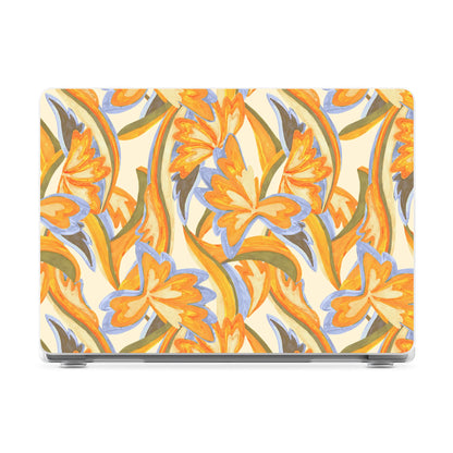 Tropical Bungalow | Watercolor Laptop Shell - 15" MacBook Air