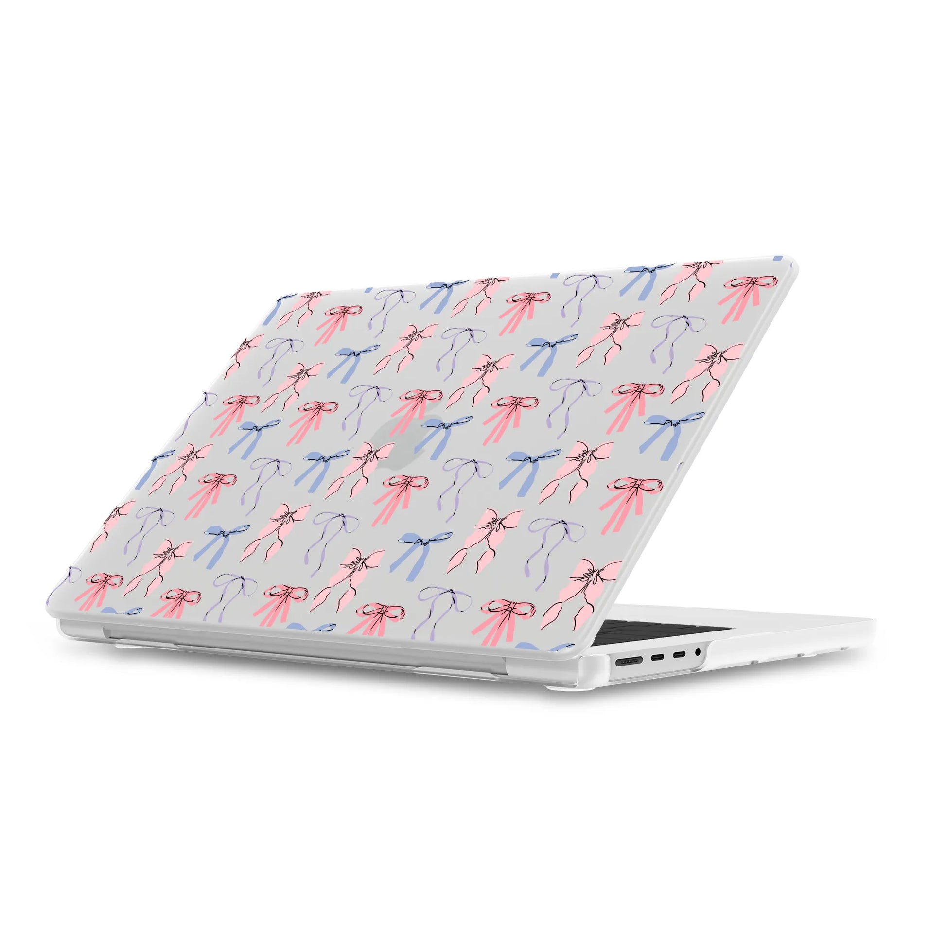 Coquette Girlie | Pastel Bows Laptop Shell